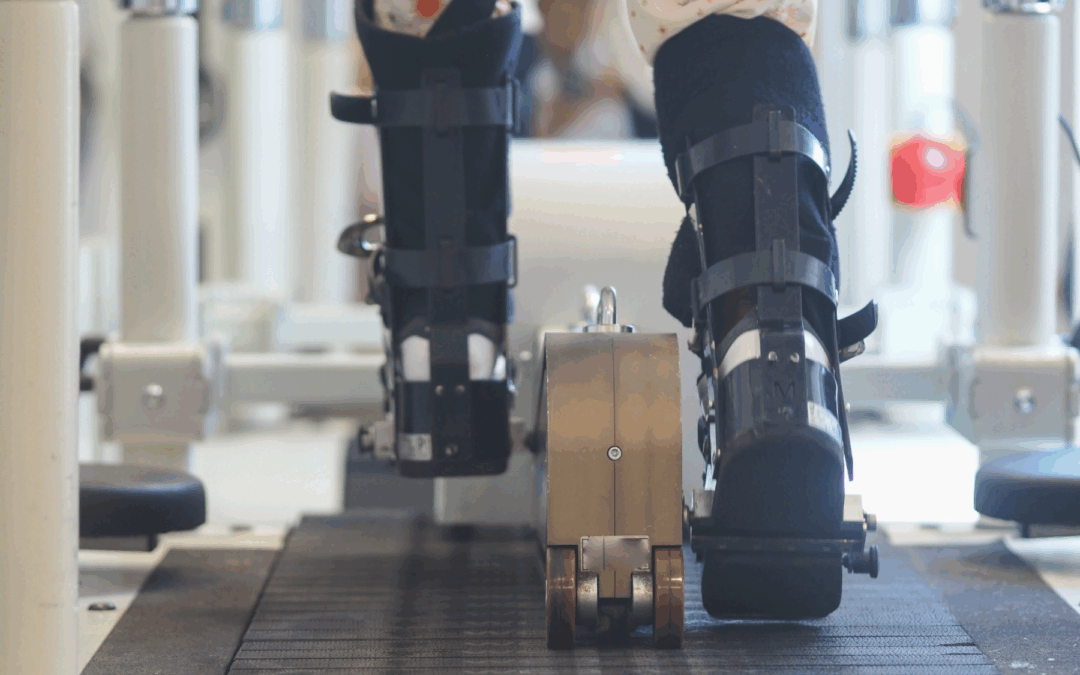 Prader–Willi Syndrome and the Extremities: Managing Hip, Foot, and Gait Problems