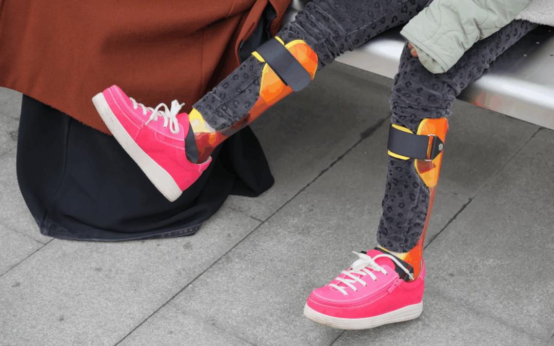 Neurofibromatosis Type 1 and the Extremities: Managing Bone Dysplasia and Limb Reconstruction