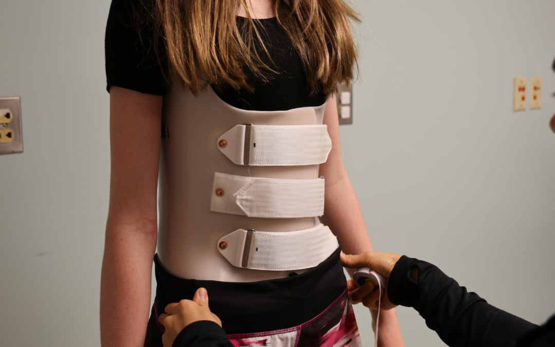 Bracing for Scoliosis: Who Needs It and How It Works