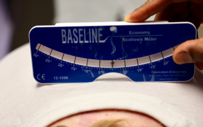 How Scoliosis Is Diagnosed: What to Expect in Your First Visit